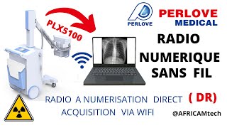 APPAREIL DE RADIO AVEC DÉTECTEUR A NUMÉRISATION DIRECT DR:  PLX5100 PERLOVE MEDICAL