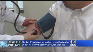 Pregnant And Nursing Moms Should Avoid Marijuana, Forehead Wrinkles May Signal Heart Disease