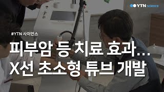 피부암 등 치료 효과...X선 초소형 튜브 개발 / YTN 사이언스