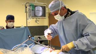 Lateral Lumbar Fusion Surgery (Xlif)