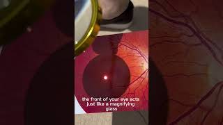 This is what happens if you stare at the SUN
