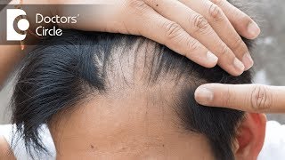 Is there a permanent treatment for male pattern hair loss? - Dr. K Prapanna Arya
