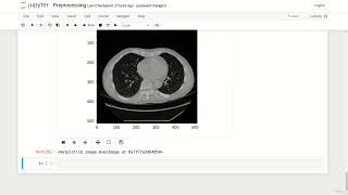 7. Data Formats in Medical Imaging - 8. Preprocessing-in-Python-Part-2