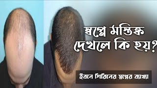 স্বপ্নে মস্তিষ্ক দেখলে কি হয় | স্বপ্নে মাথা দেখলে কি হয় | swapne matha dekhle ki hoy | dream chul