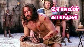 இயேசுவின் காயங்கள் | Wounds of Jesus | John 20:19,20