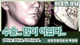 [SUB] 양악수술은 왜 했을까? 귀밑각은 왜 이렇게... [비대면상담 #141] / Why did you have maxillofacial surgery?