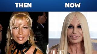 29 Celebrities Before And After Plastic Surgery The Most Dramatic Transformations