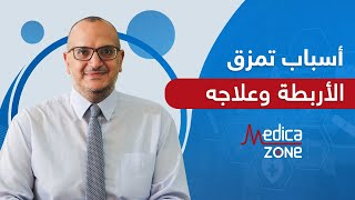 اسباب تمزق الاربطة و علاجه مع الدكتور اشرف خليل | Medicazone