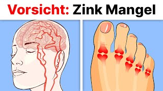 5 Anzeichen von akutem Zink-Mangel