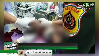 จับสุนัขจรจัด 4 ตัว รุมกัดเด็ก 7 ขวบ | 28-01-62 | ข่าวเที่ยงไทยรัฐ