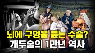 뇌에 구멍을 뚫는 수술? 개두술의 1만년 역사