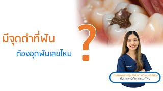 มีจุดดำที่ฟัน ต้องอุดฟันเลยไหม ? คุยกับหมอปลาย ทพญ. ปิย์วรา ภวะจันทร์สถิต