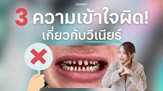 3 ความ เข้าใจผิด เกี่ยวกับ วีเนียร์ วันนี้ Cosdent Smile Design จะมาเฉลยค่ะ