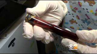 Dr. Max Gomez: Potential Alzheimer's Test Stirs Debate