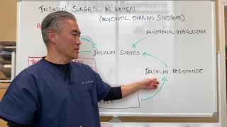 Insulin Surges in Women (Polycystic Ovarian Syndrome)-Blood Sugar and Hormone Dysregulation.