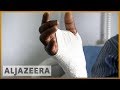 🇿🇼 Zimbabwe protests: 'Systematic torture of protesters' | Al Jazeera English