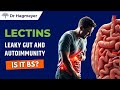 🔥Lectins, Leaky Gut, Lectins health, lectins foods, How to get rid of lectins,🔥 Dr Richard Hagmeyer