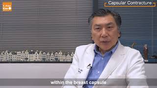 Capsular Contracture : Office of K. Alex Kim M.D.