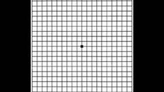 Grid for Macular Degeneration