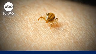 What to know about meat allergies caused by tick bites