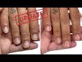 Regrowing bitten nails and acrylic damage [Watch Me Work]