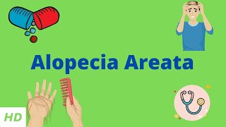 Alopecia Areata, Causes, SIgns and Symptoms, Diagnosis and Treatment.