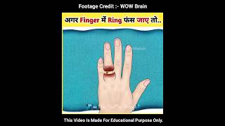 अगर Finger में Ring फंस जाए तो.. #asmr #shortsvideo
