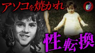 【True story】 Man whose genitals were burned and turned into a woman