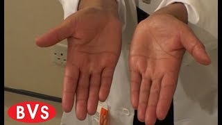 Effective Hand Hygiene - BVS Training