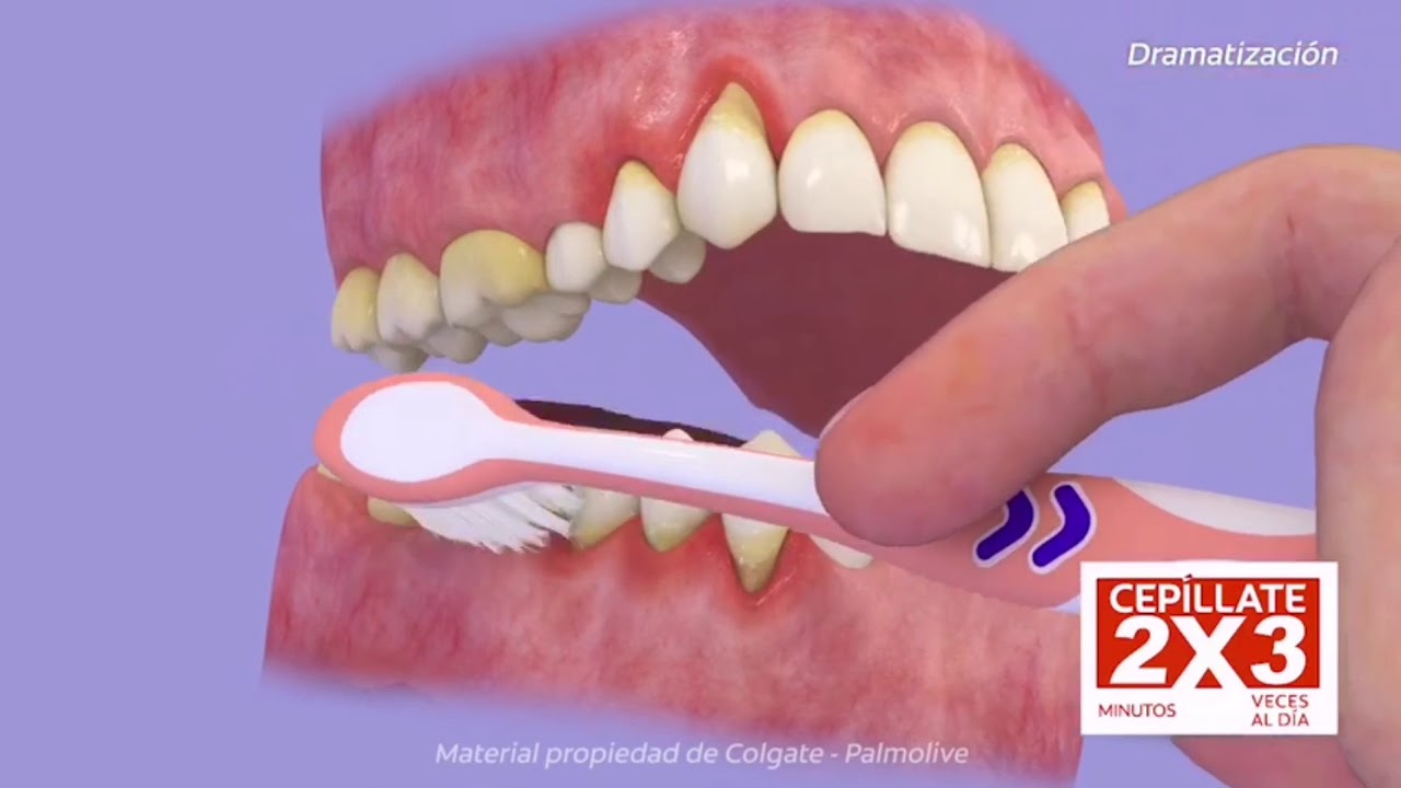 TÉCNICA DE CEPILLADO DENTAL - YouTube