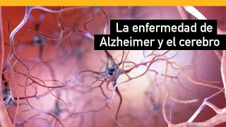 Cómo cambia la enfermedad de Alzheimer al cerebro