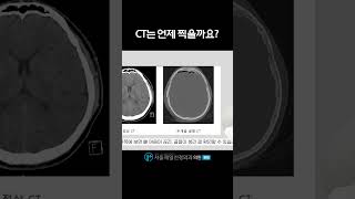 #뇌검사잘하는곳 #뇌mri #뇌mra