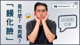 饅化臉是什麼？有救嗎 ？｜林進達醫師