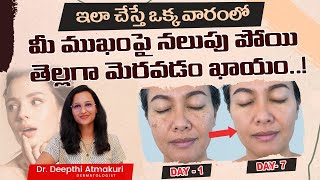 నల్లని ముఖం తెల్లగా మారాలంటే..! || How to Remove Pigmentation Naturally at Home? || Clinica Derm