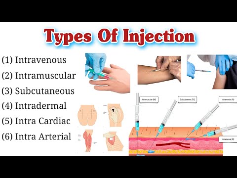 What is the means of injection?
