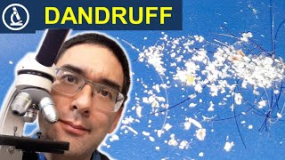 DANDRUFF under the microscope 🔬 Found on the keyboard