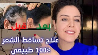 كيفاش عالجت تساقط الشعر بمواد ١٠٠٪ طبيعية 🍃🥰تفاصيل قبل و بعد و النتائج  فالفيديو