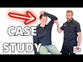 How I Diagnose and Treat Cervical Radiculopathy [CASE STUDY Physical Therapy]