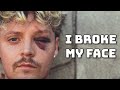 I Broke My Face (LIVE Storytime)