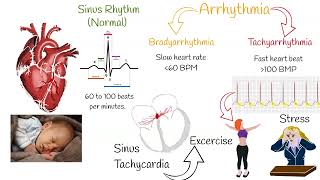 Tachycardia - Most Common causes and Symptoms