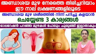 അണ്ഡാശയ മുഴ നേരത്തെ തിരിച്ചറിയാം|ഈ 4 ലക്ഷണങ്ങളിലൂടെ|