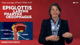 The digestive system - Food going down the wrong way