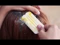 big dandruff flakes scalp scratching and picking satisfying dandruff removal 12