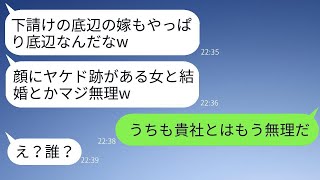 下請けの俺を見下し、結婚式で顔に火傷のある妻を笑い者にした取引先の社員「底辺だから嫁も底辺だなw」→ある人物を怒らせたクズ男の結末がひどいwww