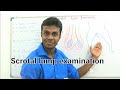 Scrotal Lump examination By Dr Dinusha