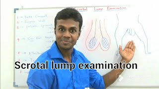 Scrotal Lump examination By Dr Dinusha