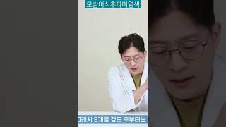 #모발이식후주의사항 파마.염색은 언제부터