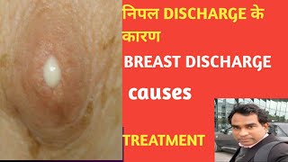 NIPPLE DISCHARGE/BREAST DISCHARGE CAUSES (GLACTORRHEA)