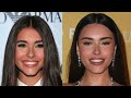 new madison beer plastic surgery update what i didn t see the first time...