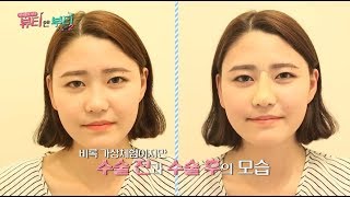 [뷰티앤부티 시즌2] _ 9회 올리브성형외과